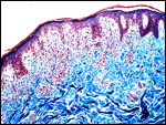 Dermatopathology Slide: TRI Stain